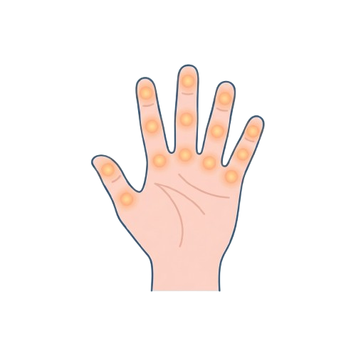 Hand Diagram Showing Pressure Points for Palm and Fingers - Rheumatoid Arthritis Awareness Day 19