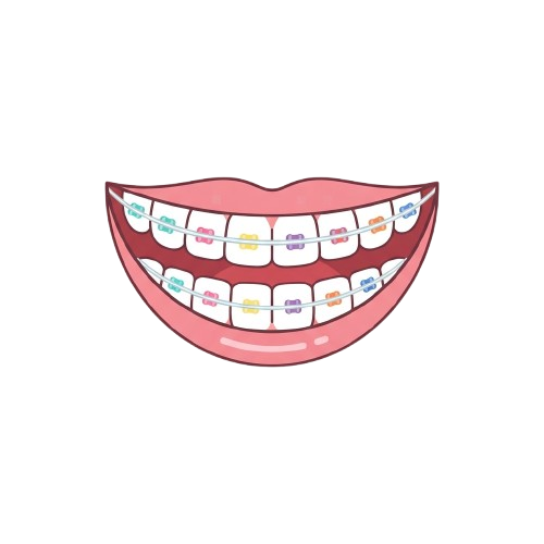 A smiling mouth with colorful orthodontic braces on both upper and lower teeth