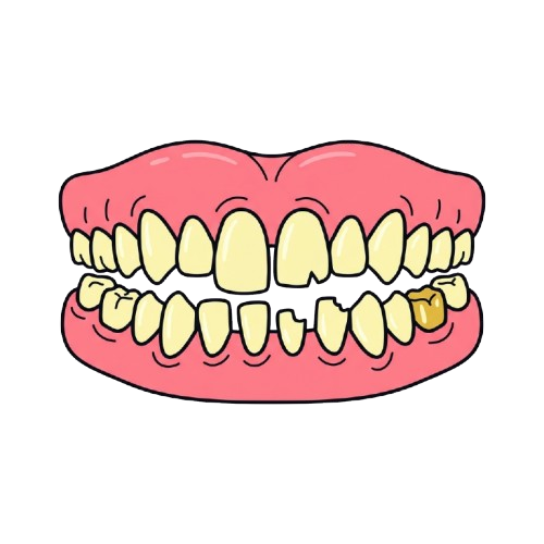 Cartoon depiction of a smiling mouth with a single gold-colored tooth