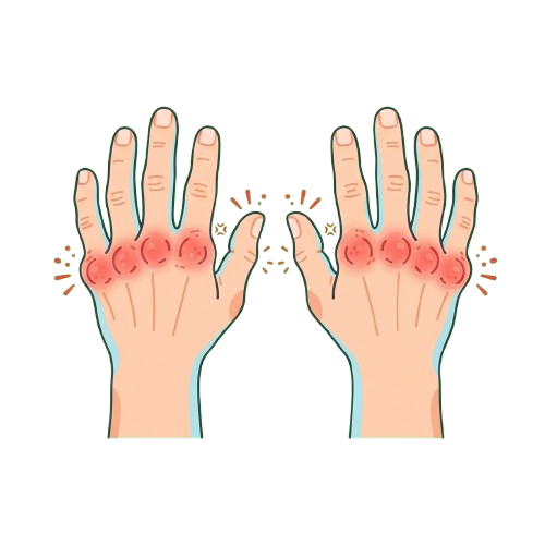 Two hands with red, inflamed knuckles and small scaly flakes around fingers